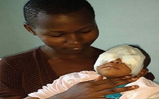 samantha after surgery